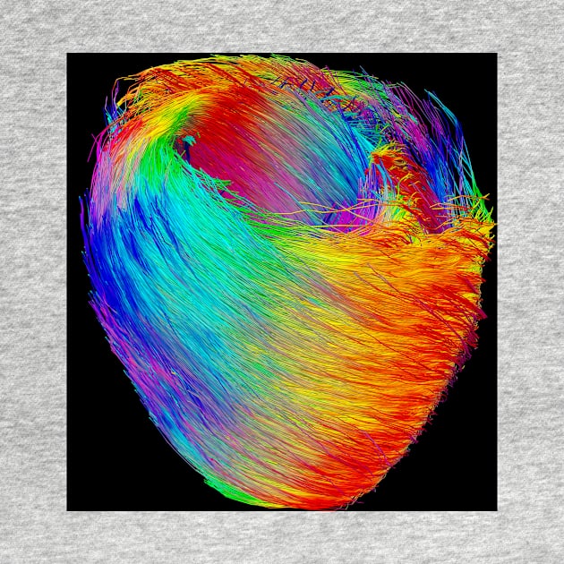 Heart muscle fibres, DTI scan (C021/5126) by SciencePhoto